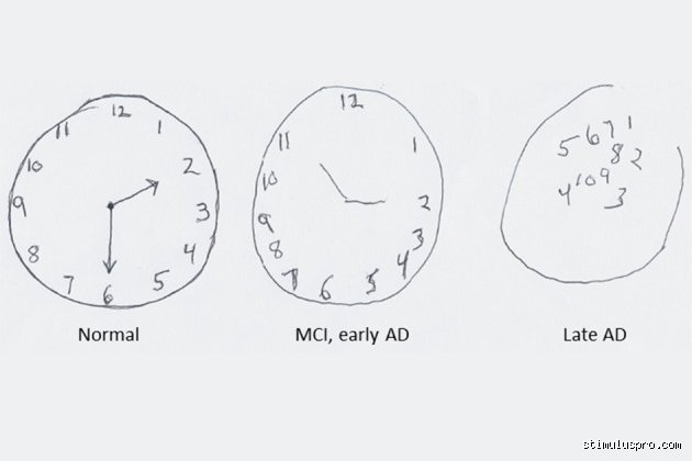 ¿Cuál es el test del reloj?