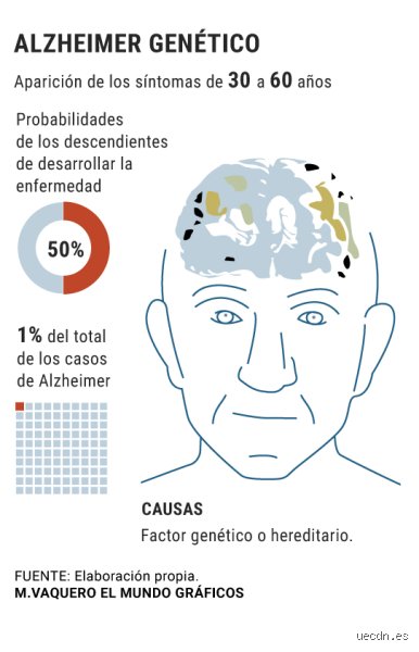 ¿Cuál es la edad más temprana para el Alzheimer?