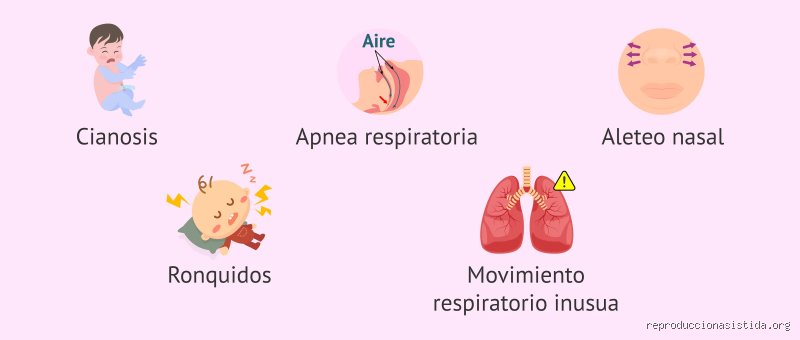 ¿Cuál es uno de los primeros signos de dificultad respiratoria?
