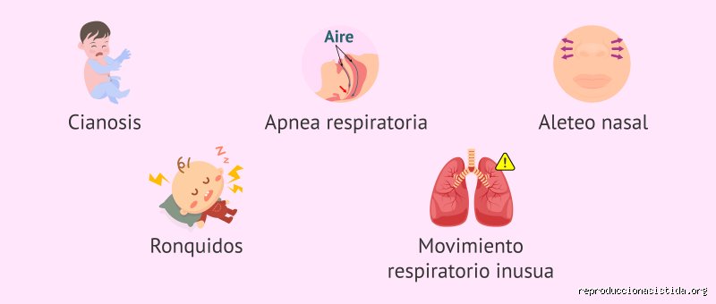¿Cuáles son 4 signos de dificultad respiratoria?