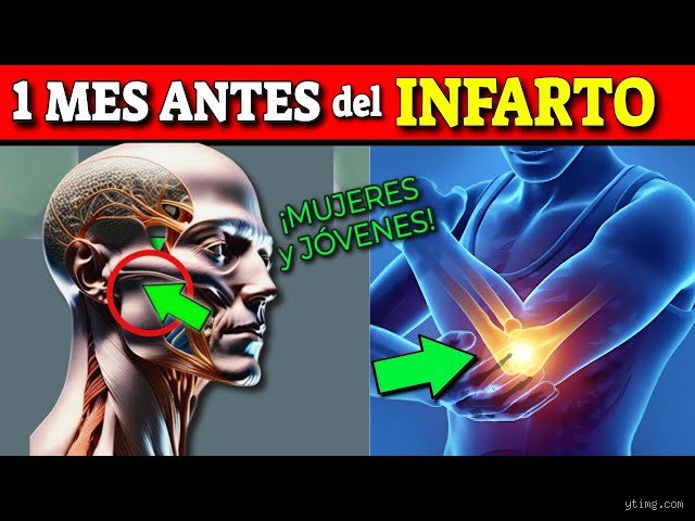 ¿Cuáles son las 7 señales antes de un infarto?