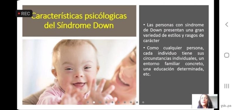 ¿Cuáles son las características psicológicas del síndrome de Down?