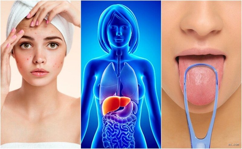 ¿Cuáles son las señales de que tu hígado se está desintoxicando?