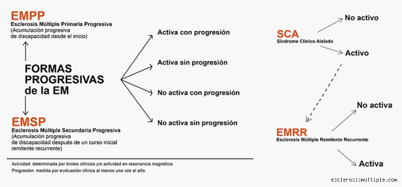 ¿Cuáles son los 4 tipos de esclerosis múltiple?