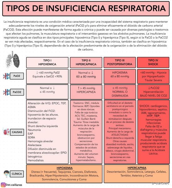 ¿Cuáles son los 4 tipos de insuficiencia respiratoria?
