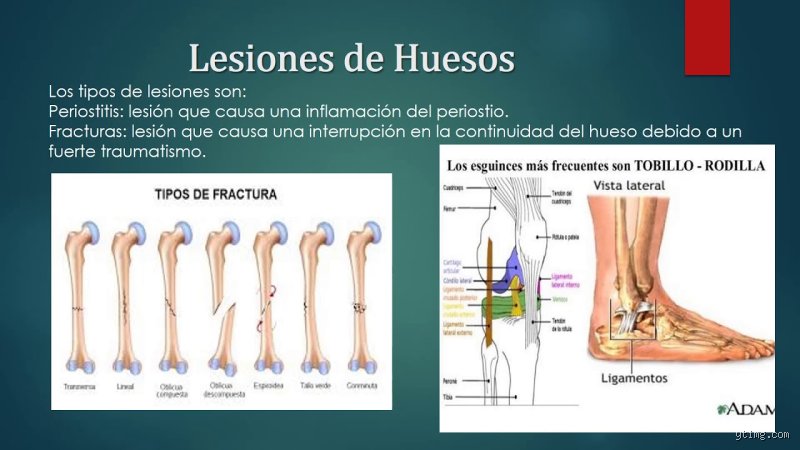 ¿Cuáles son los 4 tipos de lesiones?