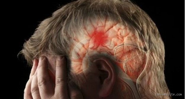 ¿Cuáles son los primeros síntomas de un coágulo de sangre en el cerebro?