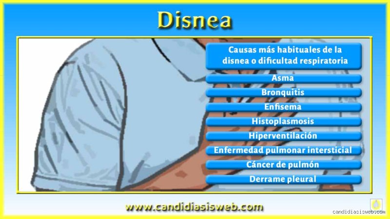 ¿Cuáles son tres signos graves de disnea?