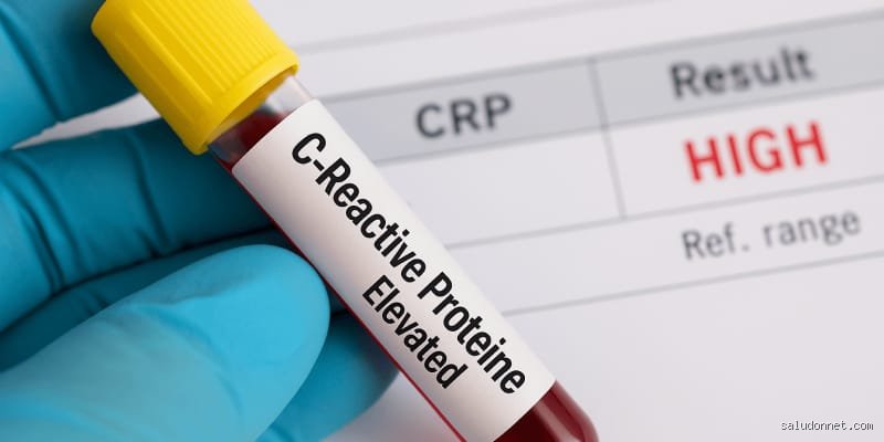 ¿Cuándo es preocupante la proteína C reactiva?