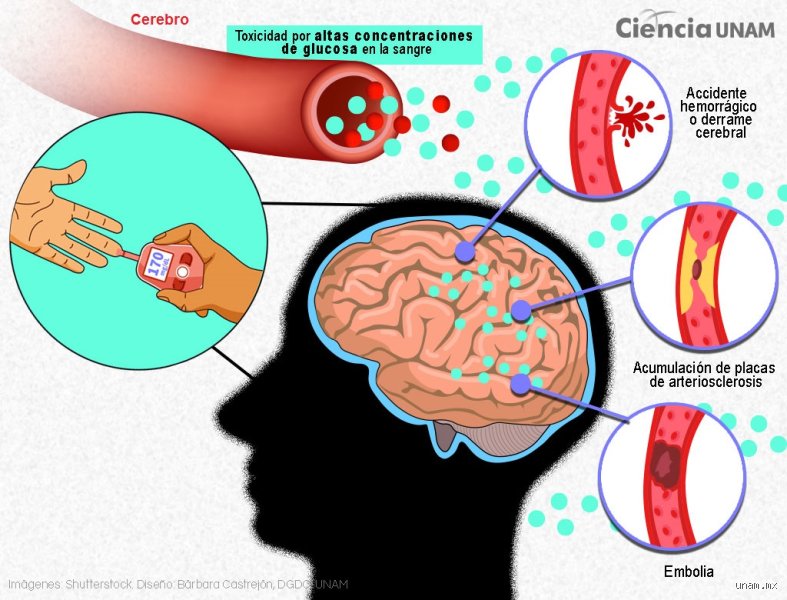 ¿Cuando se sube el azúcar duele el cerebro.?