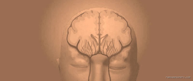 ¿Cuántas veces puede repetirse un accidente cerebrovascular?