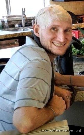 ¿Cuánto tiempo ha vivido una persona con un glioblastoma?