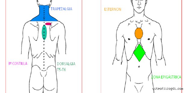 ¿Dónde duele cuando hay problemas de cervicales?