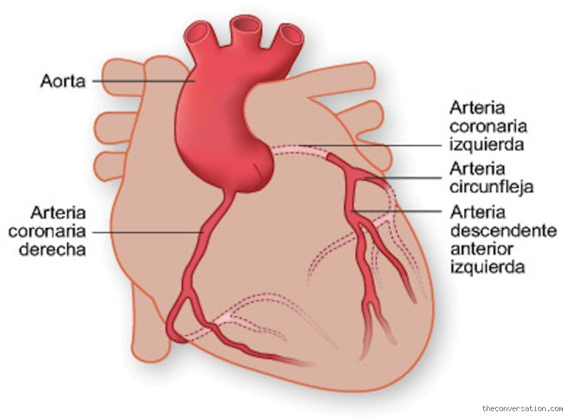 ¿Dónde duele el corazón en un infarto?