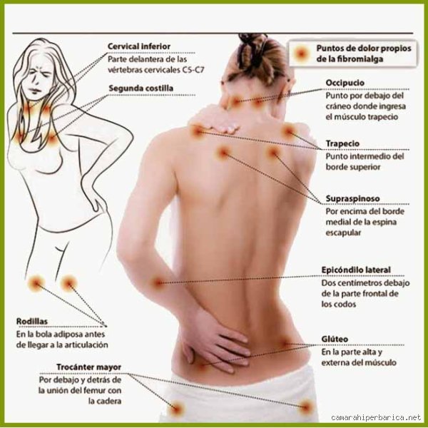 ¿Dónde duele la fibromialgia?