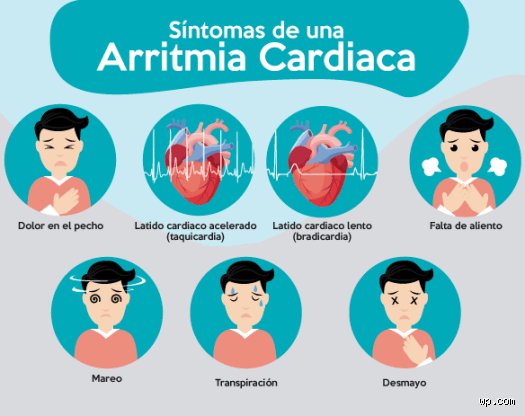 ¿Dónde te duele cuando tienes arritmia?