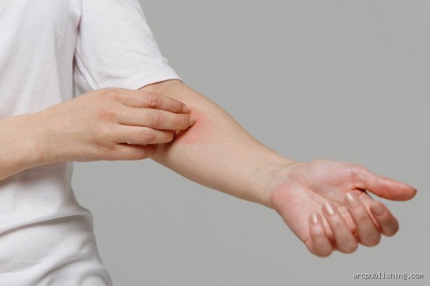 ¿Dónde te pica cuando tienes diabetes?