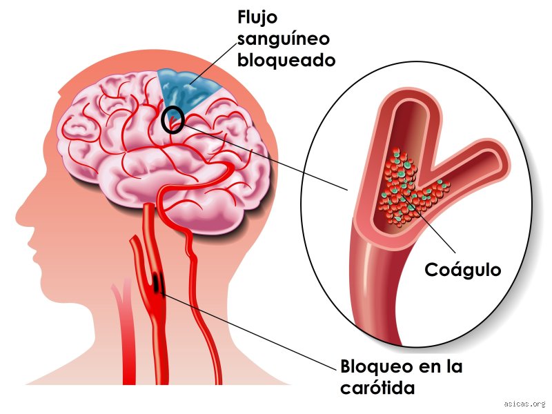 ¿El daño cerebral es reversible?