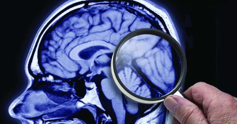 ¿El daño cerebral permanente implica la muerte?