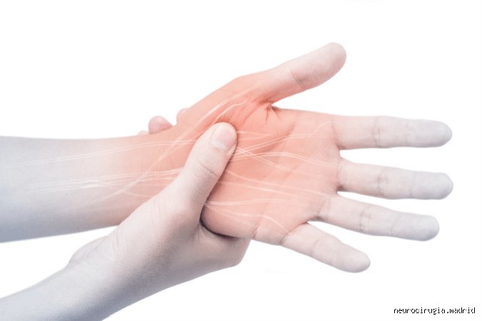 ¿El dolor neuropático es grave?