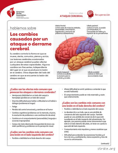 ¿Es posible recuperarse de una lesión cerebral en el lado izquierdo?
