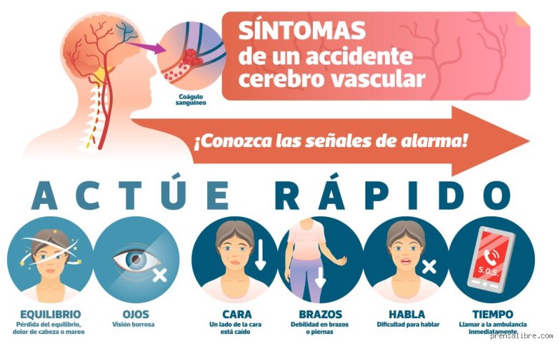 ¿Existen señales días antes de sufrir un derrame cerebral?