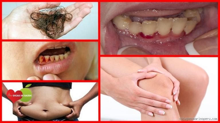 ¿Puede la deficiencia de vitamina C causar fatiga extrema?