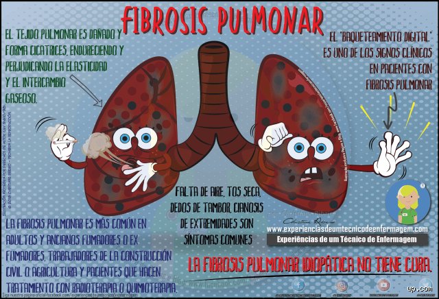 ¿Qué siente una persona con fibrosis pulmonar?