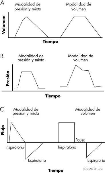 ¿Respirador significa última etapa?