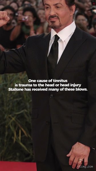 ¿Sylvester Stallone tiene tinnitus?