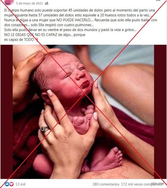 ¿A cuántos huesos rotos equivale el dolor de un parto?