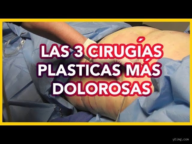 ¿Cuáles son las 3 cirugías más dolorosas?