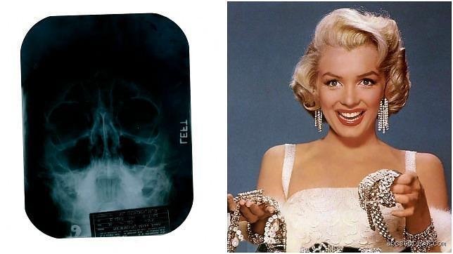¿Qué cirugías tenía Marilyn Monroe?