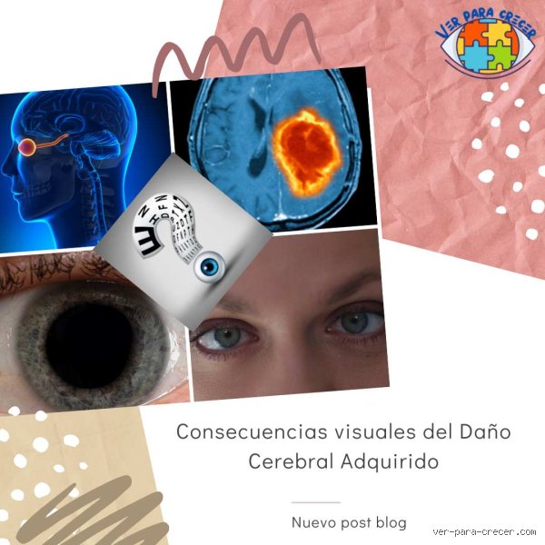 ¿Puede empeorar el daño cerebral con el tiempo?