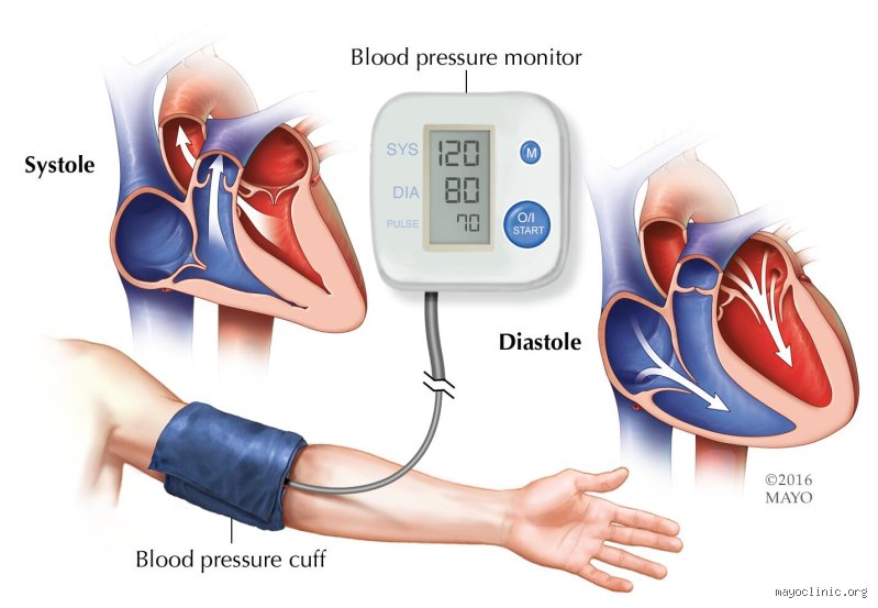 ¿Cómo saber si todavía necesitas medicación para la presión arterial?