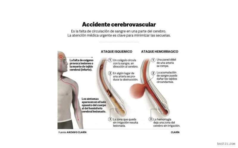 ¿Tomar aspirina todos los días es bueno o malo?