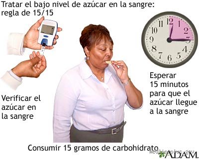 ¿Cuál es la regla de los 15 minutos para el nivel de azúcar en sangre?
