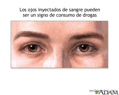 ¿Cómo es la mirada de una persona que se droga?