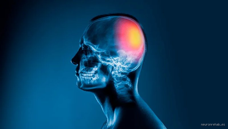 ¿La lesión cerebral adquirida es salud mental?