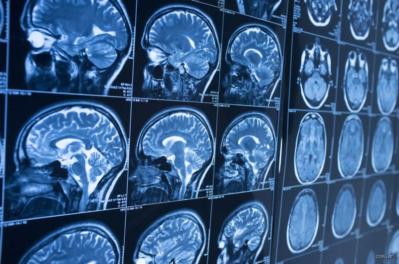¿Cuáles son las tres edades claves en las que el cerebro se deteriora drásticamente?