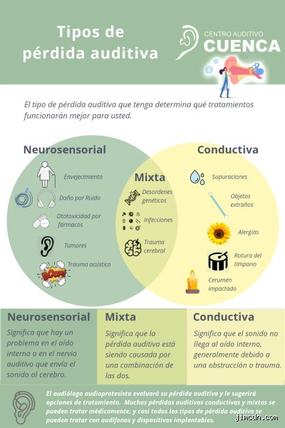 ¿Cuáles son las 3 capacidades auditivas más importantes?
