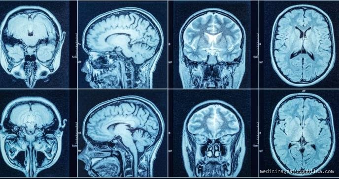 ¿Dormir reinicia el cerebro?