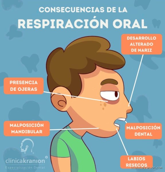 ¿La respiración bucal afecta al sueño?