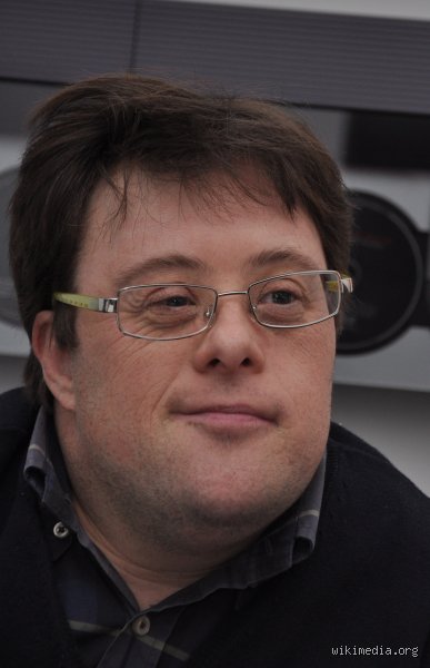 ¿Cuál es el tipo de síndrome de Down más inteligente?