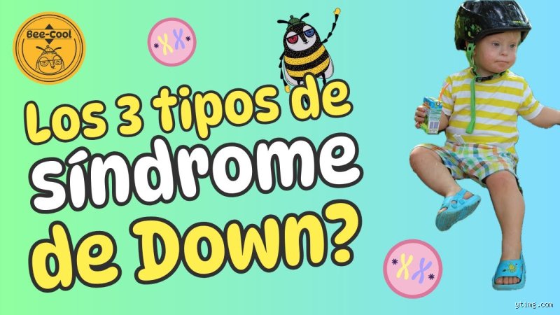 ¿Cuáles son los 3 tipos de Down?