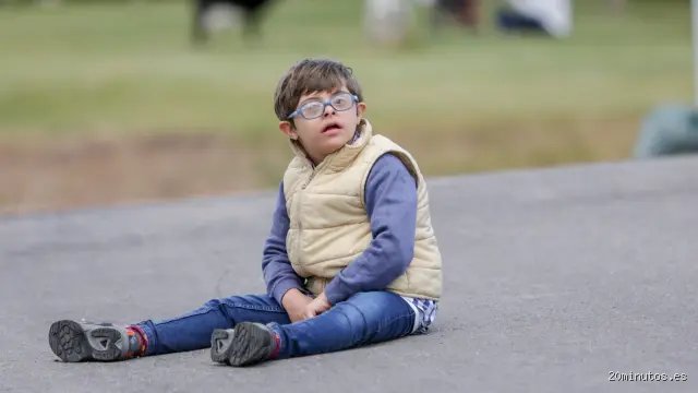 ¿Cuántos años duran los niños con síndrome Down?