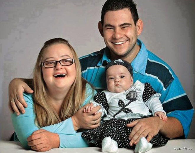 ¿Las personas con síndrome de Down tienen hijos normales?